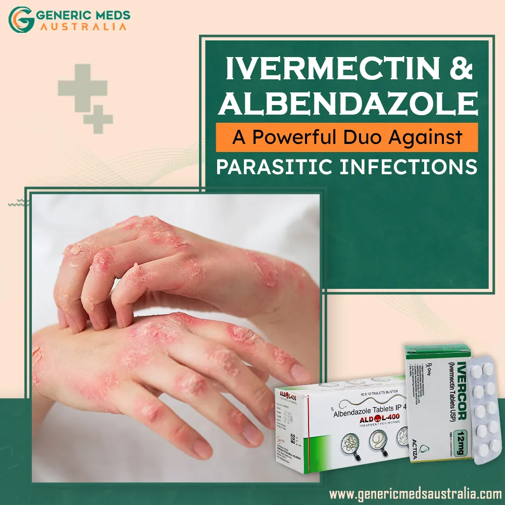 Ivermectin and Albendazole - A Powerful Duo against Parasitic Infections