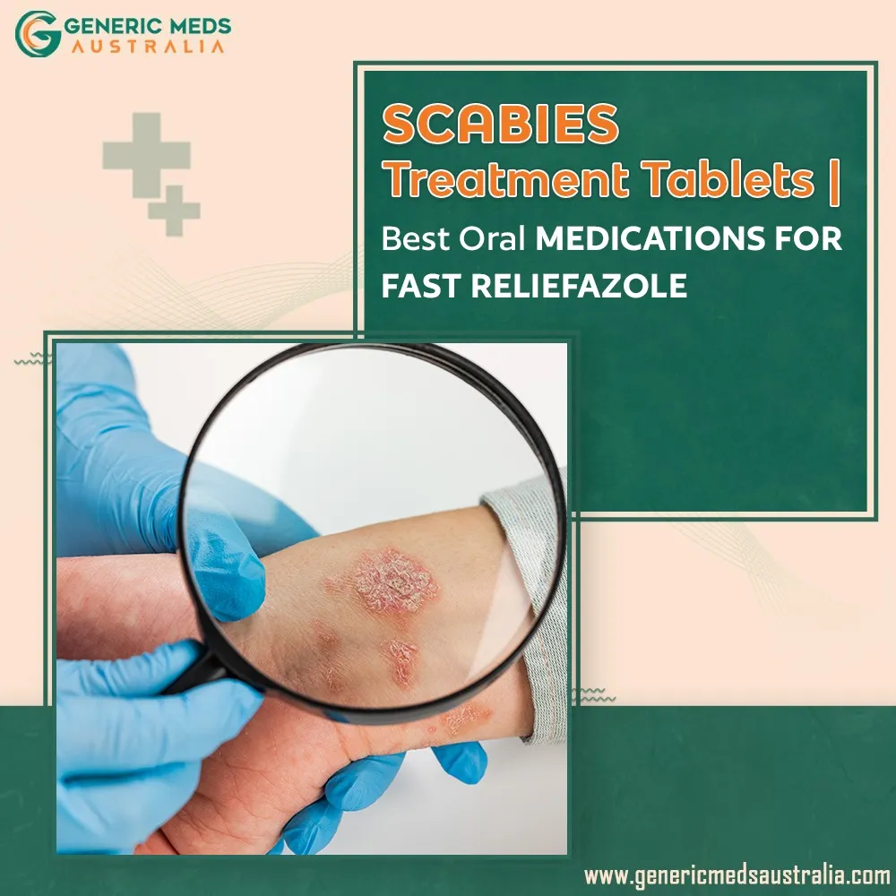 Scabies Treatment Tablets Best Oral Medications for Fast Relief
