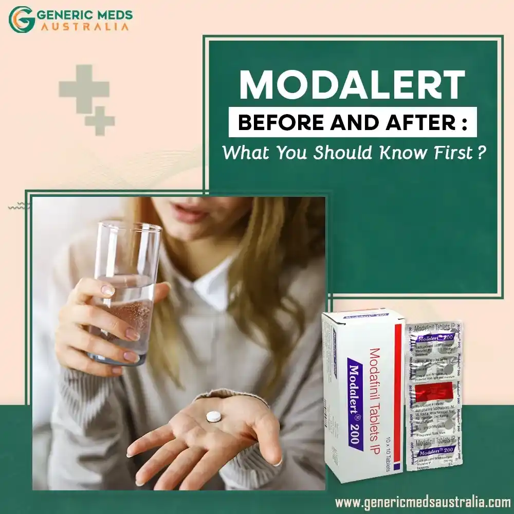 Modalert Before and After: What You Should Know First?